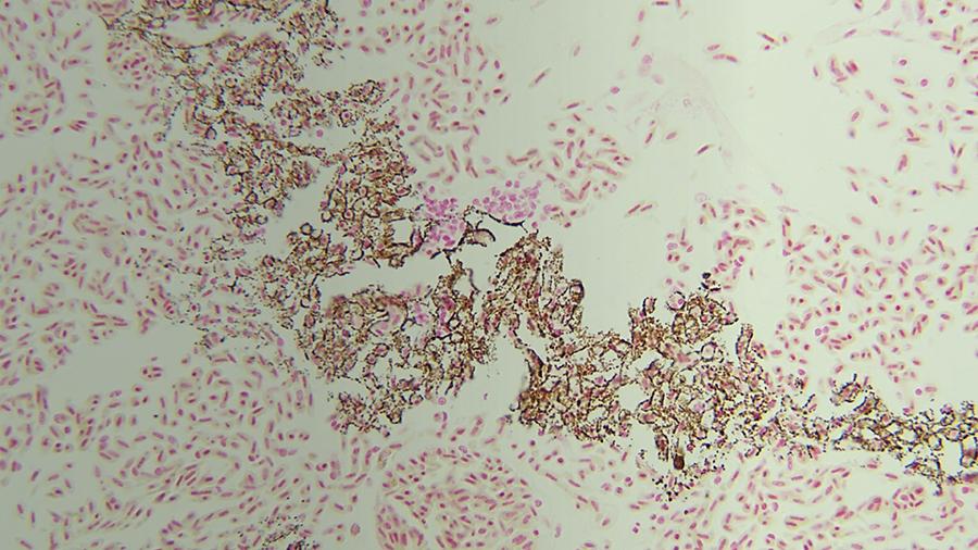 Lung Vascular Wall Mineralization Von Kossa Stain