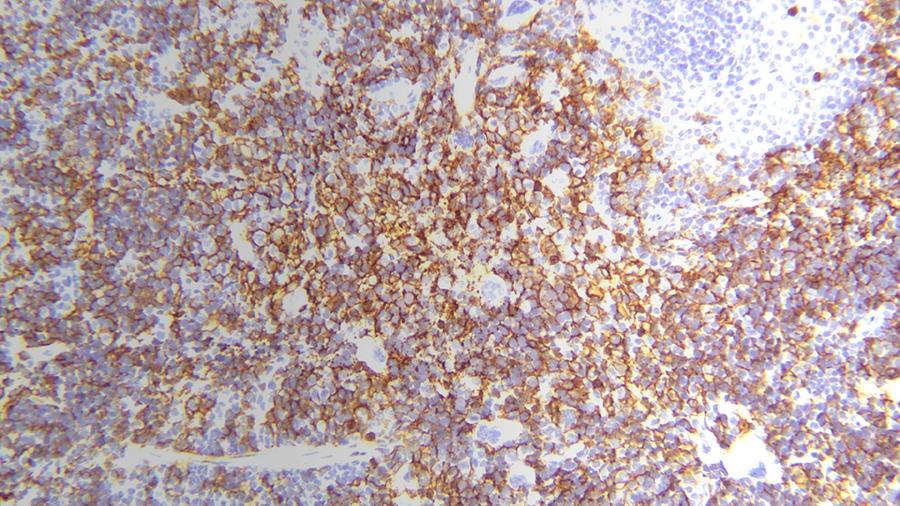 Spleen F4/80 IHC