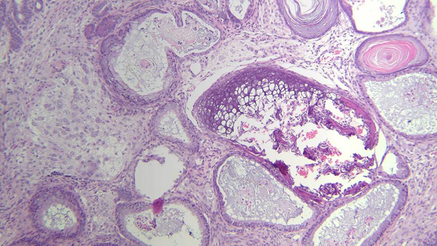 Mouse Ovary Hematoxylin & Eosin (H&E) Ovarian Teratoma